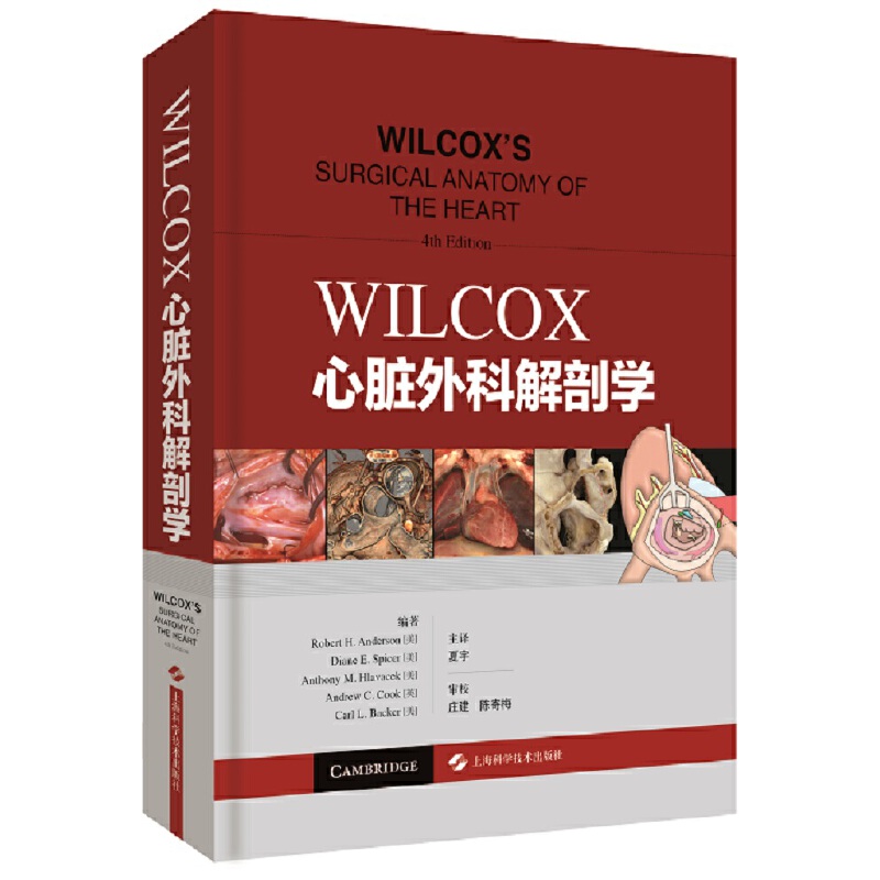 WILCOXKƽʌW