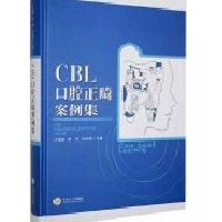 CBLǻ